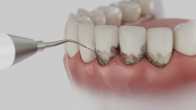 Trusted Dental Crowns And Bridges service in Hyde Park, UT - Dentist Open Now